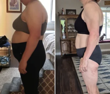Kathy, before and after, side view